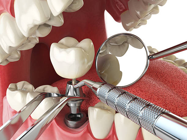 Best Root Canal Emergency Dentist  in Royalton, IL